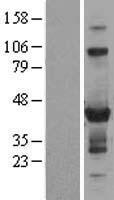 Western blot validation of overexpression lysate (Cat# LY404316) using anti-DDK antibody (Cat# TA50011-100). Left: Cell lysates from un-transfected HEK293T cells; Right: Cell lysates from HEK293T cells transfected with RC209589 using transfection reagent MegaTran 2.0 (Cat# TT210002).