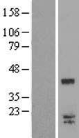 Western blot validation of overexpression lysate (Cat# LY421667) using anti-DDK antibody (Cat# TA50011-100). Left: Cell lysates from un-transfected HEK293T cells; Right: Cell lysates from HEK293T cells transfected with RC220215 using transfection reagent MegaTran 2.0 (Cat# TT210002).