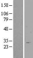Western blot validation of overexpression lysate (Cat# LY408669) using anti-DDK antibody (Cat# TA50011-100). Left: Cell lysates from un-transfected HEK293T cells; Right: Cell lysates from HEK293T cells transfected with RC209970 using transfection reagent MegaTran 2.0 (Cat# TT210002).