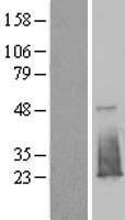 Western blot validation of overexpression lysate (Cat# LY413263) using anti-DDK antibody (Cat# TA50011-100). Left: Cell lysates from un-transfected HEK293T cells; Right: Cell lysates from HEK293T cells transfected with RC209938 using transfection reagent MegaTran 2.0 (Cat# TT210002).