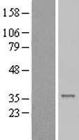 Western blot validation of overexpression lysate (Cat# LY423313) using anti-DDK antibody (Cat# TA50011-100). Left: Cell lysates from un-transfected HEK293T cells; Right: Cell lysates from HEK293T cells transfected with RC209959 using transfection reagent MegaTran 2.0 (Cat# TT210002).