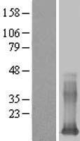 Western blot validation of overexpression lysate (Cat# LY415702) using anti-DDK antibody (Cat# TA50011-100). Left: Cell lysates from un-transfected HEK293T cells; Right: Cell lysates from HEK293T cells transfected with RC209738 using transfection reagent MegaTran 2.0 (Cat# TT210002).