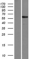 Western blot validation of overexpression lysate (Cat# LY420928) using anti-DDK antibody (Cat# TA50011-100). Left: Cell lysates from un-transfected HEK293T cells; Right: Cell lysates from HEK293T cells transfected with RC219326 using transfection reagent MegaTran 2.0 (Cat# TT210002).