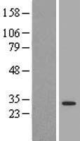 Western blot validation of overexpression lysate (Cat# LY416397) using anti-DDK antibody (Cat# TA50011-100). Left: Cell lysates from un-transfected HEK293T cells; Right: Cell lysates from HEK293T cells transfected with RC208646 using transfection reagent MegaTran 2.0 (Cat# TT210002).