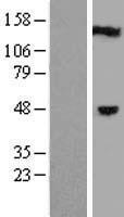 Western blot validation of overexpression lysate (Cat# LY409810) using anti-DDK antibody (Cat# TA50011-100). Left: Cell lysates from un-transfected HEK293T cells; Right: Cell lysates from HEK293T cells transfected with RC209613 using transfection reagent MegaTran 2.0 (Cat# TT210002).