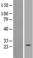 Western blot validation of overexpression lysate (Cat# LY422852) using anti-DDK antibody (Cat# TA50011-100). Left: Cell lysates from un-transfected HEK293T cells; Right: Cell lysates from HEK293T cells transfected with RC210355 using transfection reagent MegaTran 2.0 (Cat# TT210002).