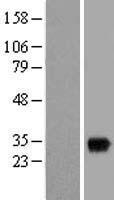 Western blot validation of overexpression lysate (Cat# LY415626) using anti-DDK antibody (Cat# TA50011-100). Left: Cell lysates from un-transfected HEK293T cells; Right: Cell lysates from HEK293T cells transfected with RC210611 using transfection reagent MegaTran 2.0 (Cat# TT210002).