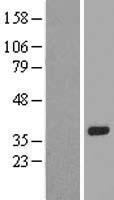 Western blot validation of overexpression lysate (Cat# LY421115) using anti-DDK antibody (Cat# TA50011-100). Left: Cell lysates from un-transfected HEK293T cells; Right: Cell lysates from HEK293T cells transfected with RC210736 using transfection reagent MegaTran 2.0 (Cat# TT210002).
