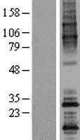 Western blot validation of overexpression lysate (Cat# LY407193) using anti-DDK antibody (Cat# TA50011-100). Left: Cell lysates from un-transfected HEK293T cells; Right: Cell lysates from HEK293T cells transfected with RC211295 using transfection reagent MegaTran 2.0 (Cat# TT210002).