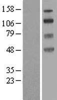 Western blot validation of overexpression lysate (Cat# LY414657) using anti-DDK antibody (Cat# TA50011-100). Left: Cell lysates from un-transfected HEK293T cells; Right: Cell lysates from HEK293T cells transfected with RC211351 using transfection reagent MegaTran 2.0 (Cat# TT210002).