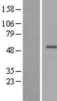 Western blot validation of overexpression lysate (Cat# LY406565) using anti-DDK antibody (Cat# TA50011-100). Left: Cell lysates from un-transfected HEK293T cells; Right: Cell lysates from HEK293T cells transfected with RC210987 using transfection reagent MegaTran 2.0 (Cat# TT210002).