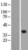 Western blot validation of overexpression lysate (Cat# LY405507) using anti-DDK antibody (Cat# TA50011-100). Left: Cell lysates from un-transfected HEK293T cells; Right: Cell lysates from HEK293T cells transfected with RC211031 using transfection reagent MegaTran 2.0 (Cat# TT210002).