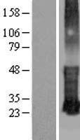 Western blot validation of overexpression lysate (Cat# LY406322) using anti-DDK antibody (Cat# TA50011-100). Left: Cell lysates from un-transfected HEK293T cells; Right: Cell lysates from HEK293T cells transfected with RC210983 using transfection reagent MegaTran 2.0 (Cat# TT210002).