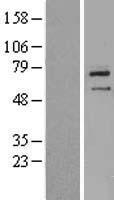Western blot validation of overexpression lysate (Cat# LY409241) using anti-DDK antibody (Cat# TA50011-100). Left: Cell lysates from un-transfected HEK293T cells; Right: Cell lysates from HEK293T cells transfected with RC211145 using transfection reagent MegaTran 2.0 (Cat# TT210002).