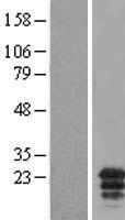 Western blot validation of overexpression lysate (Cat# LY406400) using anti-DDK antibody (Cat# TA50011-100). Left: Cell lysates from un-transfected HEK293T cells; Right: Cell lysates from HEK293T cells transfected with RC211156 using transfection reagent MegaTran 2.0 (Cat# TT210002).