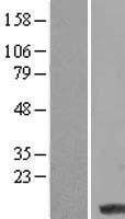 Western blot validation of overexpression lysate (Cat# LY409998) using anti-DDK antibody (Cat# TA50011-100). Left: Cell lysates from un-transfected HEK293T cells; Right: Cell lysates from HEK293T cells transfected with RC211021 using transfection reagent MegaTran 2.0 (Cat# TT210002).
