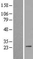Western blot validation of overexpression lysate (Cat# LY405531) using anti-DDK antibody (Cat# TA50011-100). Left: Cell lysates from un-transfected HEK293T cells; Right: Cell lysates from HEK293T cells transfected with RC211241 using transfection reagent MegaTran 2.0 (Cat# TT210002).