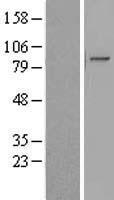 Western blot validation of overexpression lysate (Cat# LY408802) using anti-DDK antibody (Cat# TA50011-100). Left: Cell lysates from un-transfected HEK293T cells; Right: Cell lysates from HEK293T cells transfected with RC211245 using transfection reagent MegaTran 2.0 (Cat# TT210002).