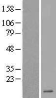 Western blot validation of overexpression lysate (Cat# LY419661) using anti-DDK antibody (Cat# TA50011-100). Left: Cell lysates from un-transfected HEK293T cells; Right: Cell lysates from HEK293T cells transfected with RC210229 using transfection reagent MegaTran 2.0 (Cat# TT210002).
