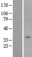 Western blot validation of overexpression lysate (Cat# LY419988) using anti-DDK antibody (Cat# TA50011-100). Left: Cell lysates from un-transfected HEK293T cells; Right: Cell lysates from HEK293T cells transfected with RC201787 using transfection reagent MegaTran 2.0 (Cat# TT210002).