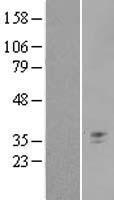 Western blot validation of overexpression lysate (Cat# LY416527) using anti-DDK antibody (Cat# TA50011-100). Left: Cell lysates from un-transfected HEK293T cells; Right: Cell lysates from HEK293T cells transfected with RC210234 using transfection reagent MegaTran 2.0 (Cat# TT210002).