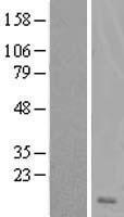 Western blot validation of overexpression lysate (Cat# LY417009) using anti-DDK antibody (Cat# TA50011-100). Left: Cell lysates from un-transfected HEK293T cells; Right: Cell lysates from HEK293T cells transfected with RC210247 using transfection reagent MegaTran 2.0 (Cat# TT210002).