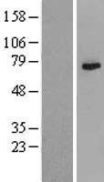 Western blot validation of overexpression lysate (Cat# LY417292) using anti-DDK antibody (Cat# TA50011-100). Left: Cell lysates from un-transfected HEK293T cells; Right: Cell lysates from HEK293T cells transfected with RC201770 using transfection reagent MegaTran 2.0 (Cat# TT210002).