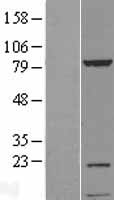Western blot validation of overexpression lysate (Cat# LY412253) using anti-DDK antibody (Cat# TA50011-100). Left: Cell lysates from un-transfected HEK293T cells; Right: Cell lysates from HEK293T cells transfected with RC210690 using transfection reagent MegaTran 2.0 (Cat# TT210002).