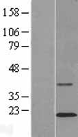Western blot validation of overexpression lysate (Cat# LY423368) using anti-DDK antibody (Cat# TA50011-100). Left: Cell lysates from un-transfected HEK293T cells; Right: Cell lysates from HEK293T cells transfected with RC211061 using transfection reagent MegaTran 2.0 (Cat# TT210002).