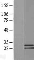 Western blot validation of overexpression lysate (Cat# LY422951) using anti-DDK antibody (Cat# TA50011-100). Left: Cell lysates from un-transfected HEK293T cells; Right: Cell lysates from HEK293T cells transfected with RC211053 using transfection reagent MegaTran 2.0 (Cat# TT210002).