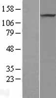 Western blot validation of overexpression lysate (Cat# LY404561) using anti-DDK antibody (Cat# TA50011-100). Left: Cell lysates from un-transfected HEK293T cells; Right: Cell lysates from HEK293T cells transfected with RC211078 using transfection reagent MegaTran 2.0 (Cat# TT210002).