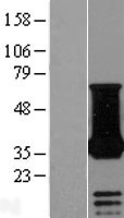 Western blot validation of overexpression lysate (Cat# LY414502) using anti-DDK antibody (Cat# TA50011-100). Left: Cell lysates from un-transfected HEK293T cells; Right: Cell lysates from HEK293T cells transfected with RC211100 using transfection reagent MegaTran 2.0 (Cat# TT210002).