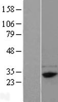 Western blot validation of overexpression lysate (Cat# LY422764) using anti-DDK antibody (Cat# TA50011-100). Left: Cell lysates from un-transfected HEK293T cells; Right: Cell lysates from HEK293T cells transfected with RC211044 using transfection reagent MegaTran 2.0 (Cat# TT210002).