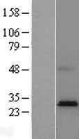 Western blot validation of overexpression lysate (Cat# LY423227) using anti-DDK antibody (Cat# TA50011-100). Left: Cell lysates from un-transfected HEK293T cells; Right: Cell lysates from HEK293T cells transfected with RC211059 using transfection reagent MegaTran 2.0 (Cat# TT210002).
