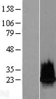 Western blot validation of overexpression lysate (Cat# LY422516) using anti-DDK antibody (Cat# TA50011-100). Left: Cell lysates from un-transfected HEK293T cells; Right: Cell lysates from HEK293T cells transfected with RC211042 using transfection reagent MegaTran 2.0 (Cat# TT210002).