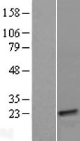 Western blot validation of overexpression lysate (Cat# LY423662) using anti-DDK antibody (Cat# TA50011-100). Left: Cell lysates from un-transfected HEK293T cells; Right: Cell lysates from HEK293T cells transfected with RC211067 using transfection reagent MegaTran 2.0 (Cat# TT210002).