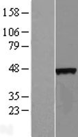 Western blot validation of overexpression lysate (Cat# LY410342) using anti-DDK antibody (Cat# TA50011-100). Left: Cell lysates from un-transfected HEK293T cells; Right: Cell lysates from HEK293T cells transfected with RC210369 using transfection reagent MegaTran 2.0 (Cat# TT210002).