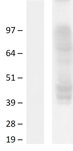 Western blot validation of overexpression lysate (Cat# LY406082) using anti-DDK antibody (Cat# TA50011-100). Left: Cell lysates from un-transfected HEK293T cells; Right: Cell lysates from HEK293T cells transfected with RC206527 using transfection reagent MegaTran 2.0 (Cat# TT210002).