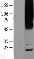 Western blot validation of overexpression lysate (Cat# LY422677) using anti-DDK antibody (Cat# TA50011-100). Left: Cell lysates from un-transfected HEK293T cells; Right: Cell lysates from HEK293T cells transfected with RC222301 using transfection reagent MegaTran 2.0 (Cat# TT210002).