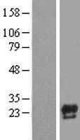 Western blot validation of overexpression lysate (Cat# LY418047) using anti-DDK antibody (Cat# TA50011-100). Left: Cell lysates from un-transfected HEK293T cells; Right: Cell lysates from HEK293T cells transfected with RC210797 using transfection reagent MegaTran 2.0 (Cat# TT210002).