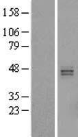 Western blot validation of overexpression lysate (Cat# LY407027) using anti-DDK antibody (Cat# TA50011-100). Left: Cell lysates from un-transfected HEK293T cells; Right: Cell lysates from HEK293T cells transfected with RC210876 using transfection reagent MegaTran 2.0 (Cat# TT210002).