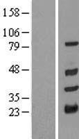 Western blot validation of overexpression lysate (Cat# LY409443) using anti-DDK antibody (Cat# TA50011-100). Left: Cell lysates from un-transfected HEK293T cells; Right: Cell lysates from HEK293T cells transfected with RC210882 using transfection reagent MegaTran 2.0 (Cat# TT210002).
