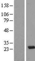 Western blot validation of overexpression lysate (Cat# LY410573) using anti-DDK antibody (Cat# TA50011-100). Left: Cell lysates from un-transfected HEK293T cells; Right: Cell lysates from HEK293T cells transfected with RC200747 using transfection reagent MegaTran 2.0 (Cat# TT210002).