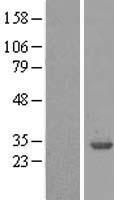 Western blot validation of overexpression lysate (Cat# LY418677) using anti-DDK antibody (Cat# TA50011-100). Left: Cell lysates from un-transfected HEK293T cells; Right: Cell lysates from HEK293T cells transfected with RC215940 using transfection reagent MegaTran 2.0 (Cat# TT210002).