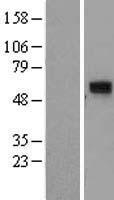 Western blot validation of overexpression lysate (Cat# LY411369) using anti-DDK antibody (Cat# TA50011-100). Left: Cell lysates from un-transfected HEK293T cells; Right: Cell lysates from HEK293T cells transfected with RC200820 using transfection reagent MegaTran 2.0 (Cat# TT210002).