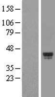 Western blot validation of overexpression lysate (Cat# LY411413) using anti-DDK antibody (Cat# TA50011-100). Left: Cell lysates from un-transfected HEK293T cells; Right: Cell lysates from HEK293T cells transfected with RC200831 using transfection reagent MegaTran 2.0 (Cat# TT210002).