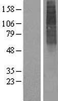Western blot validation of overexpression lysate (Cat# LY417074) using anti-DDK antibody (Cat# TA50011-100). Left: Cell lysates from un-transfected HEK293T cells; Right: Cell lysates from HEK293T cells transfected with RC201101 using transfection reagent MegaTran 2.0 (Cat# TT210002).