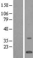 Western blot validation of overexpression lysate (Cat# LY411313) using anti-DDK antibody (Cat# TA50011-100). Left: Cell lysates from un-transfected HEK293T cells; Right: Cell lysates from HEK293T cells transfected with RC201309 using transfection reagent MegaTran 2.0 (Cat# TT210002).