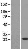 Western blot validation of overexpression lysate (Cat# LY414201) using anti-DDK antibody (Cat# TA50011-100). Left: Cell lysates from un-transfected HEK293T cells; Right: Cell lysates from HEK293T cells transfected with RC202524 using transfection reagent MegaTran 2.0 (Cat# TT210002).