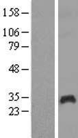 Western blot validation of overexpression lysate (Cat# LY418433) using anti-DDK antibody (Cat# TA50011-100). Left: Cell lysates from un-transfected HEK293T cells; Right: Cell lysates from HEK293T cells transfected with RC202446 using transfection reagent MegaTran 2.0 (Cat# TT210002).